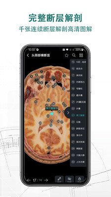 掌上3D解剖截图