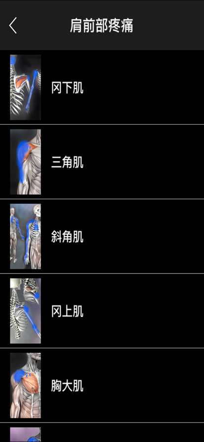 肌肉激痛点